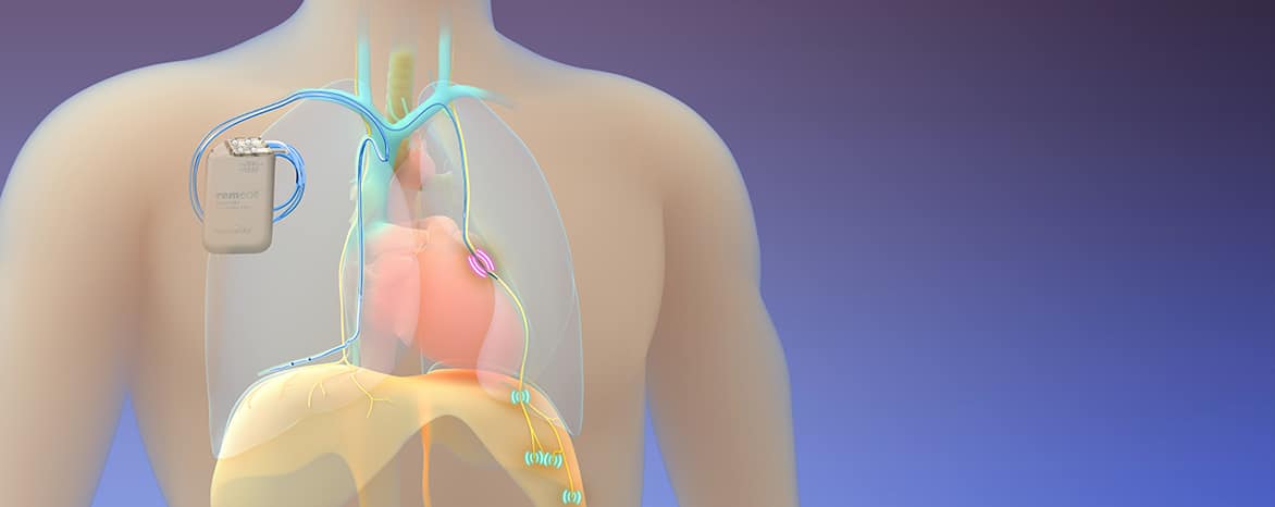 remede EX-L system with heart and lungs