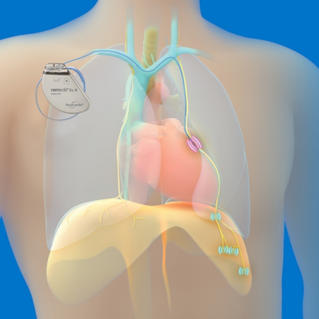 remede EX-L system with heart and lungs