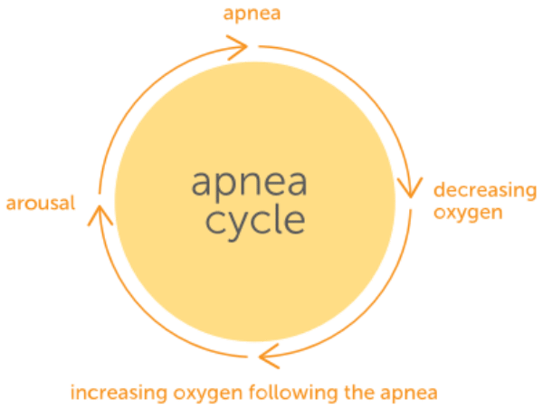 sleep apnea sleep cycle